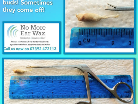 I removed this cotton bud tip with crocodile forceps this morning.