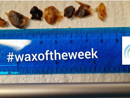 Wax of the week!