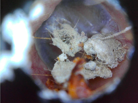 Been an interesting week! This is what a fungal infection looks like in your ear canal!